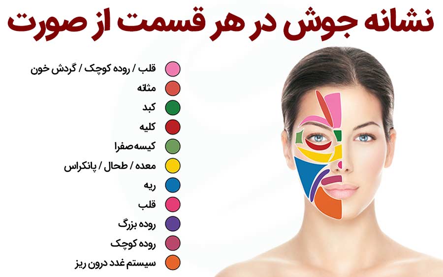 جوش‌ صورت